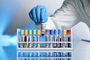 a hand of a doctor taking a blood sample tube